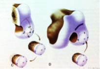 Colocação do enxerto na área da lesão.