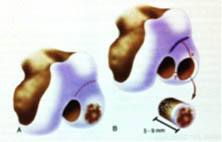 Enxerto de osso e cartilagem de doador.