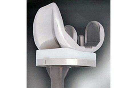 Figura de uma prótese de joelho